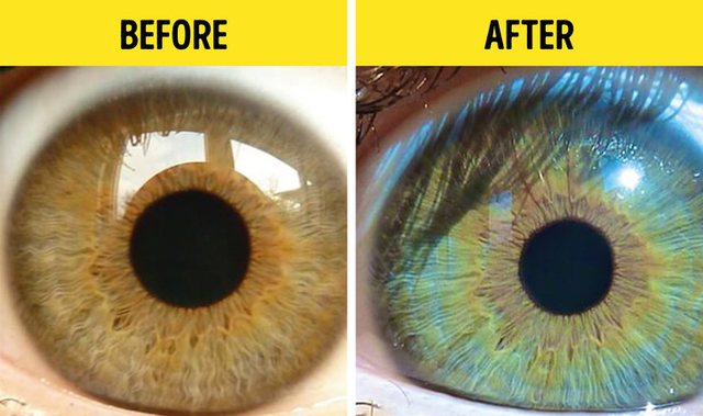 How To Change Your Eye Color by Adjusting Your Diet